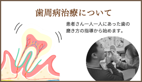 歯周病治療について