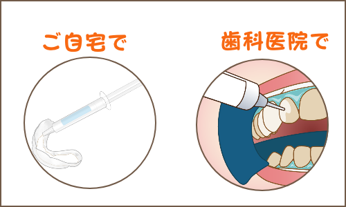 ホワイトニング2種類