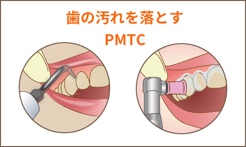 PMTC