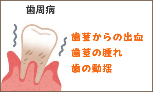 歯の揺れ
