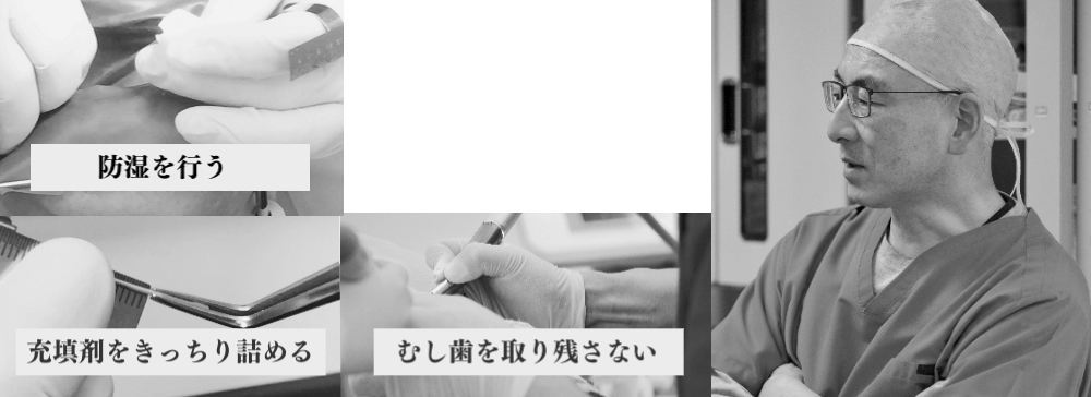 根管治療で大切な事