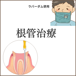 根管治療