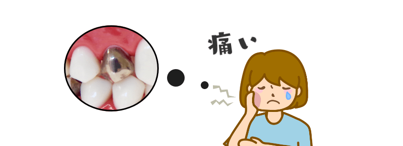 被せ物痛い女の人