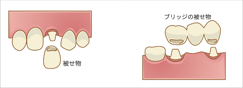 生活歯